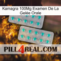 Kamagra 100Mg Examen De La Gelée Orale 29